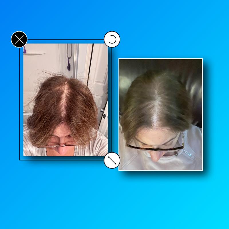 Hairmax Pro 12 Hair Growth LaserComb Device - QVC.com