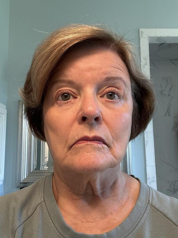 Customer carousel item 1.