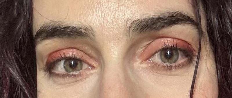 Review Thumbnail Image 0 385461005