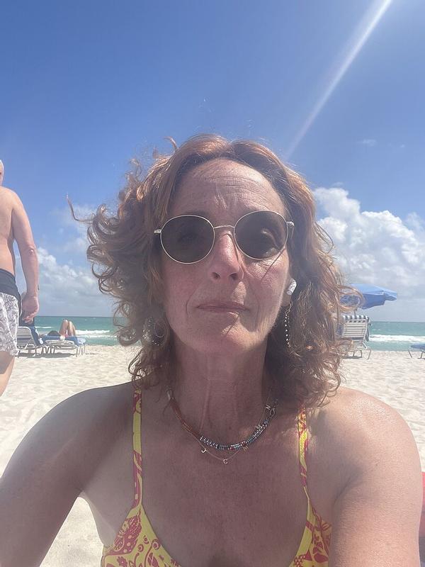 Customer photo for "Wonderful light serum."