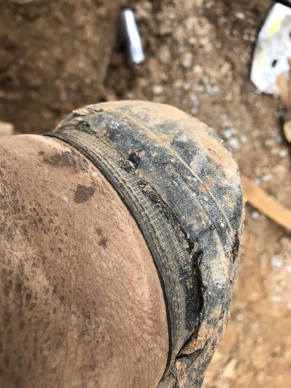 Toe separation repair right