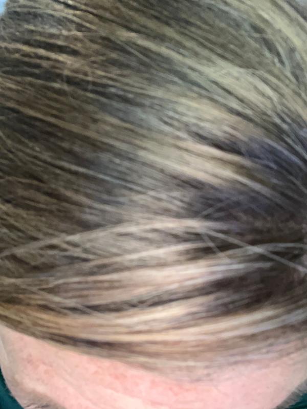 Shampoo