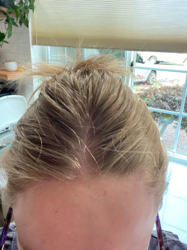 Awesome for scalp health