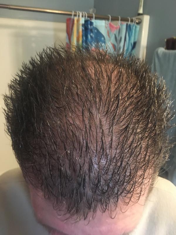 Hair with gel