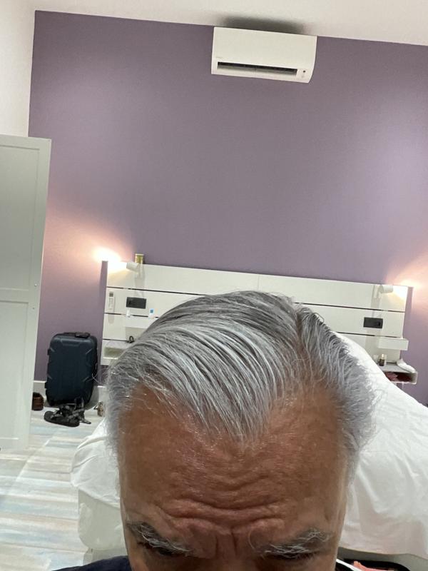 My head from the front