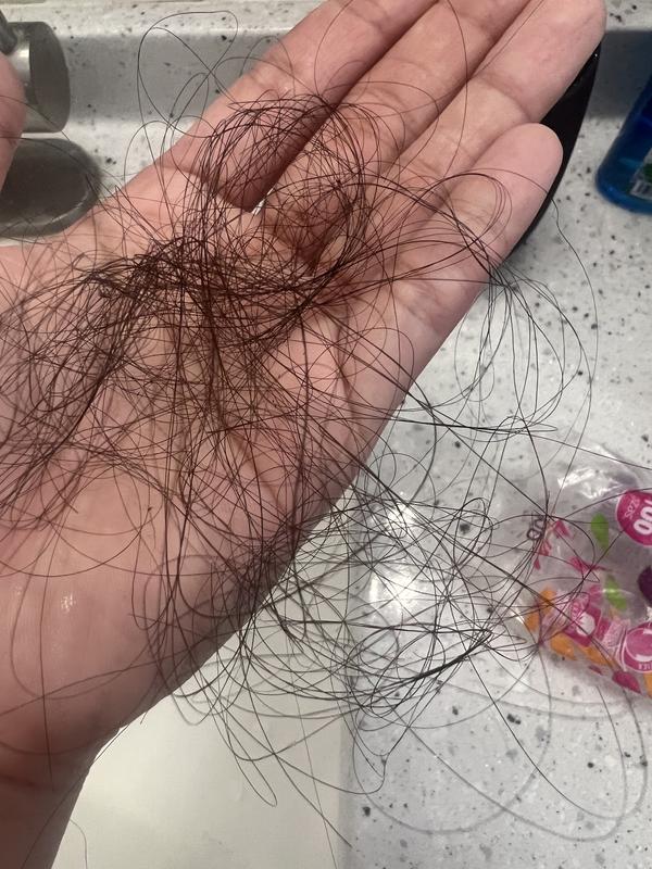 HAIR LOSS