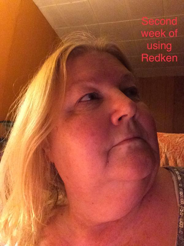 Second week after using Redken