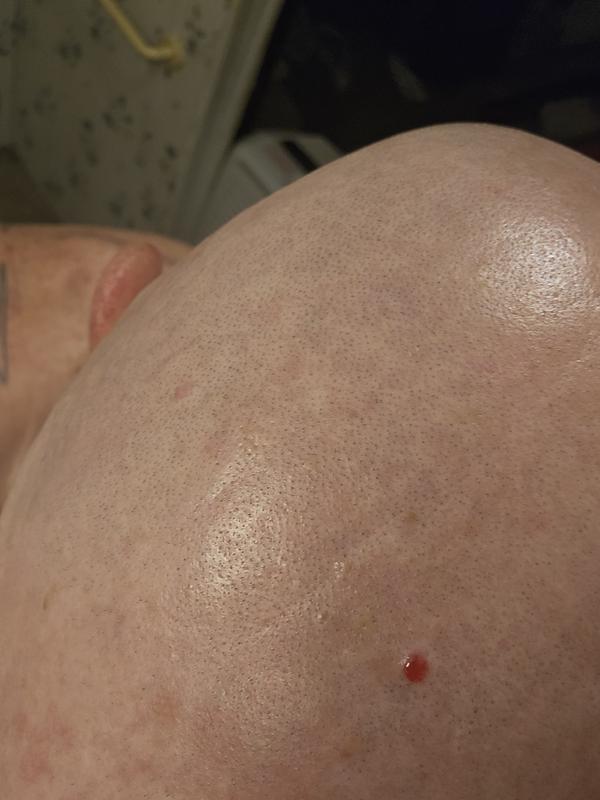 Photo - commentaire 2.