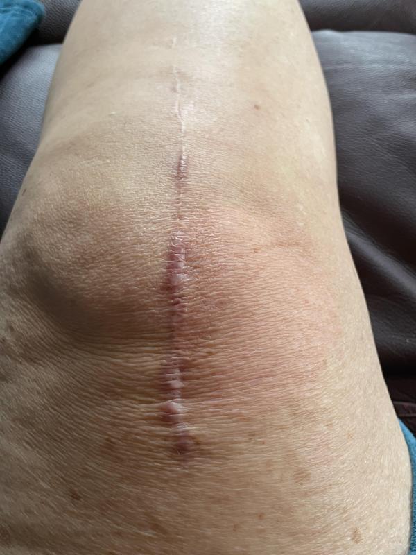 Customer photo for "Great Results in Only Three Weeks!"