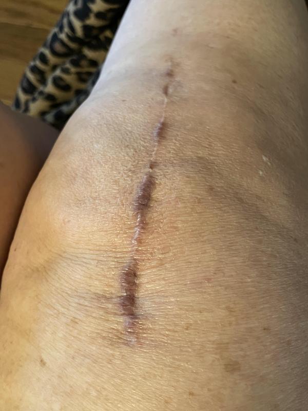 Customer photo for "Great Results in Only Three Weeks!"