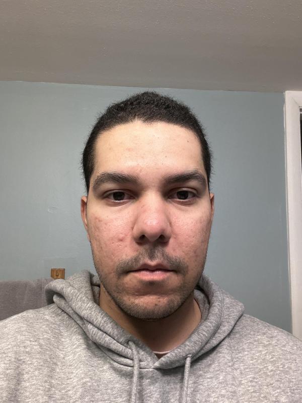 Customer photo for "I'm worried"