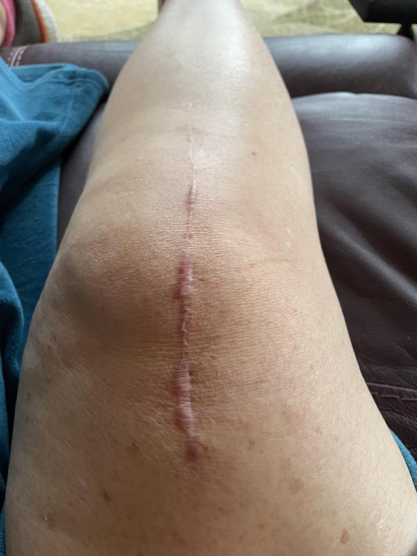 Customer photo for "Great Results in Only Three Weeks!"