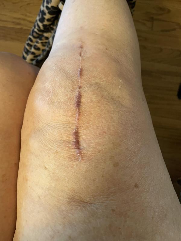 Customer photo for "Great Results in Only Three Weeks!"