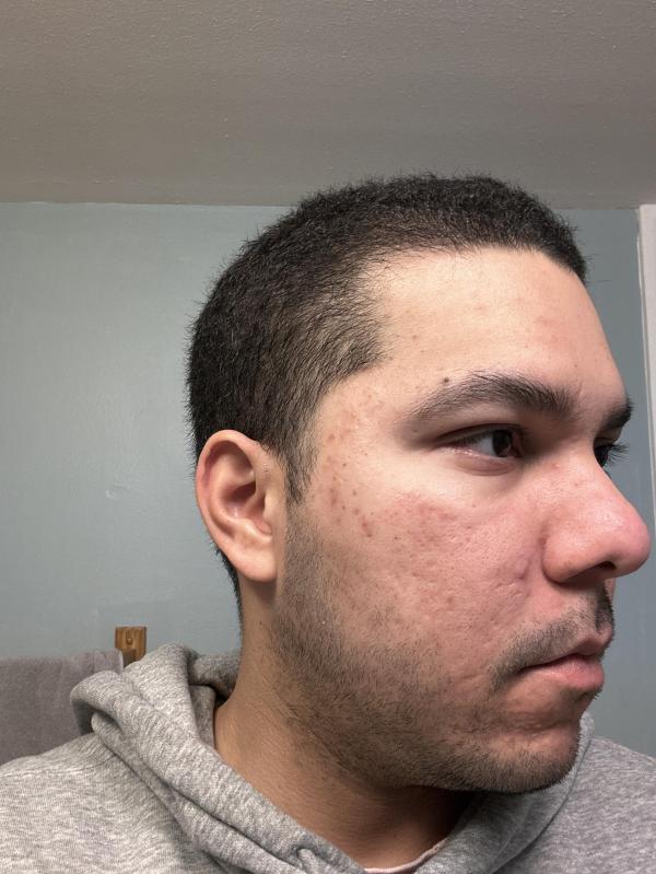 Customer photo for "I'm worried"
