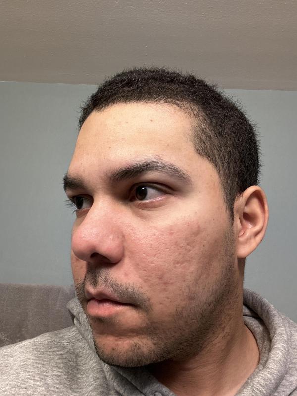 Customer photo for "I'm worried"