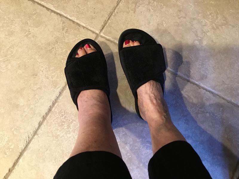Customer photo for "Great shoe after surgery"
