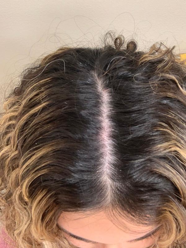 Customer photo for "Life changing oil"