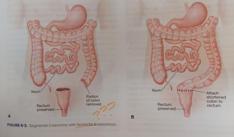 Wound, Ostomy, and Continence Nurses Society Core