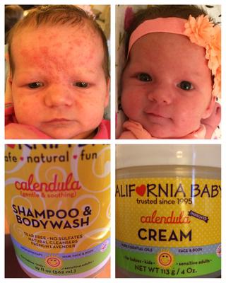 california baby calendula cream canada