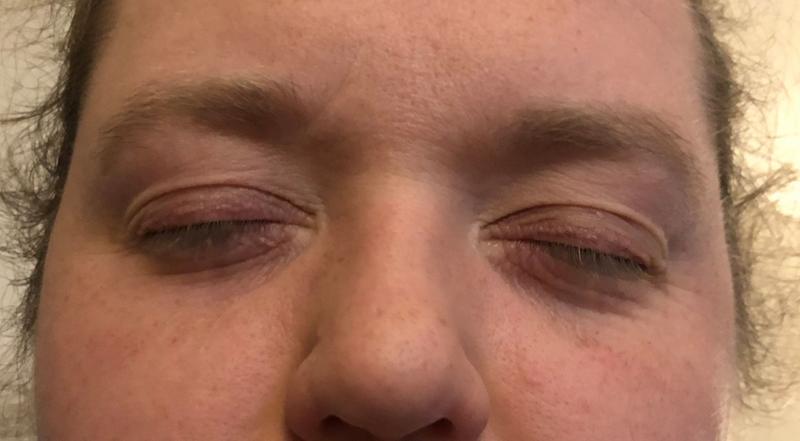 Looking at this picture, the eye on the left is the one I applied it to.