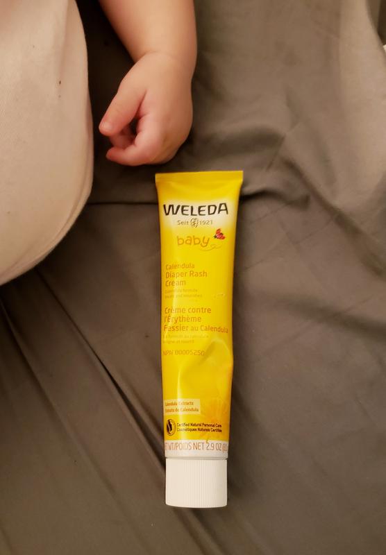 diaper cream