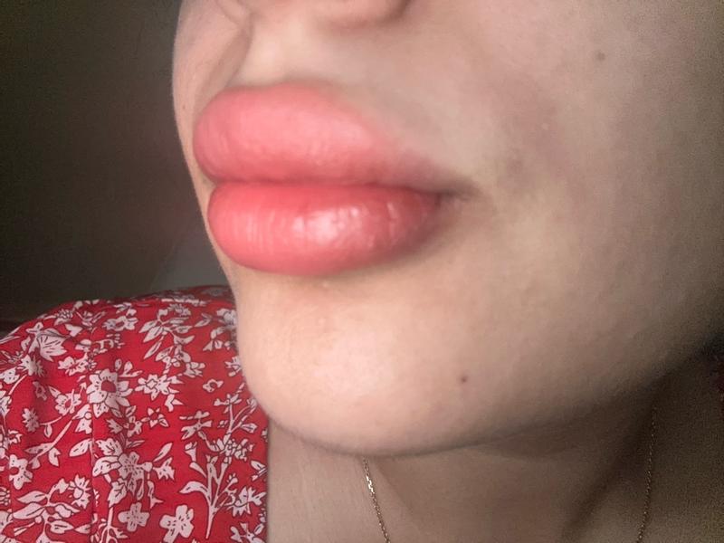 Customer photo for "Most hydrating lip balm!"
