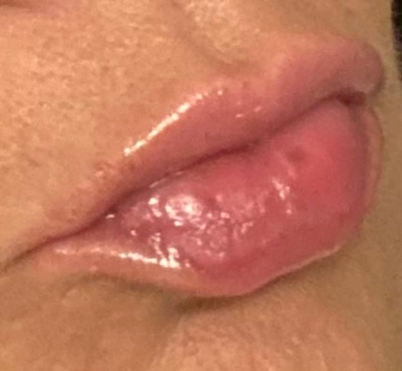 Big lips