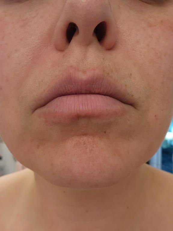 Review Thumbnail Image 0 230606269