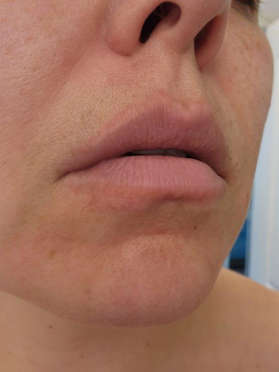 Review Thumbnail Image 1 230606269