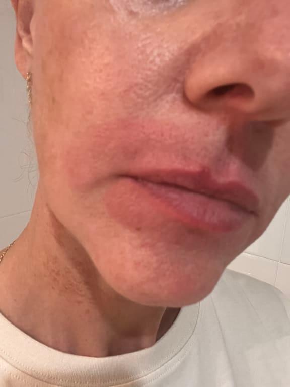 Face is now ruined