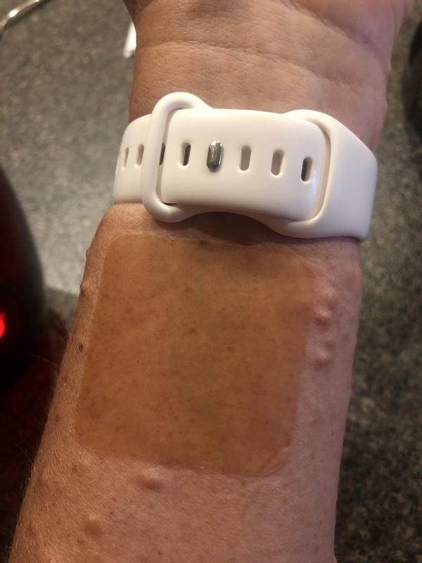 Customer photo for "Tolerate"