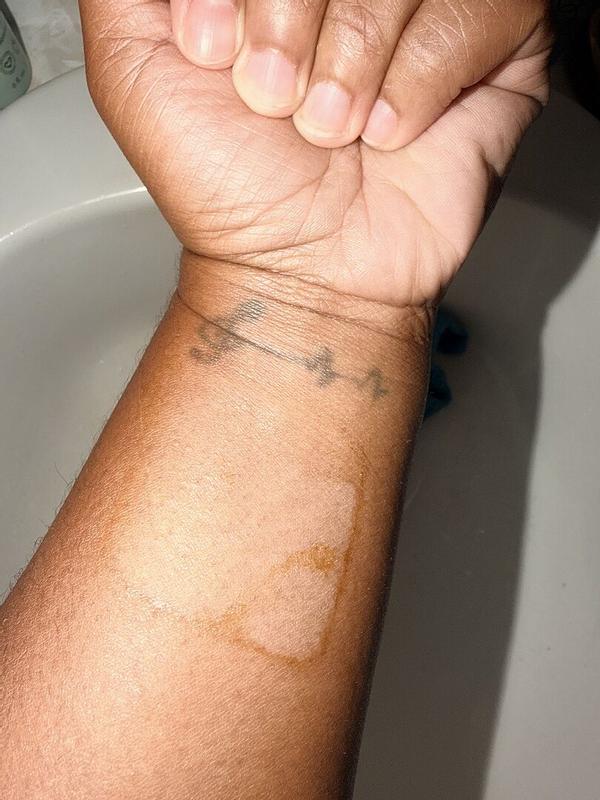 Customer photo for "Itchy"
