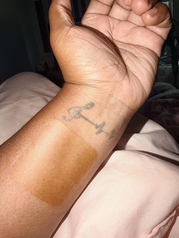 Customer photo for "Itchy"