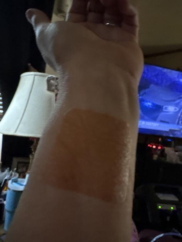 Customer photo for "B12 Awake patch is awesome!!"