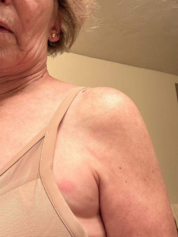 Customer photo for "This fits great, but there"