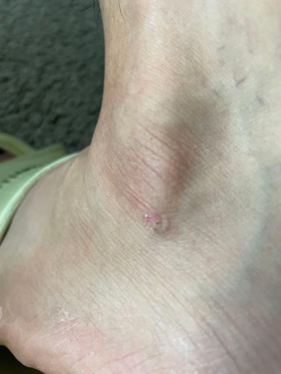 Customer photo for "No"