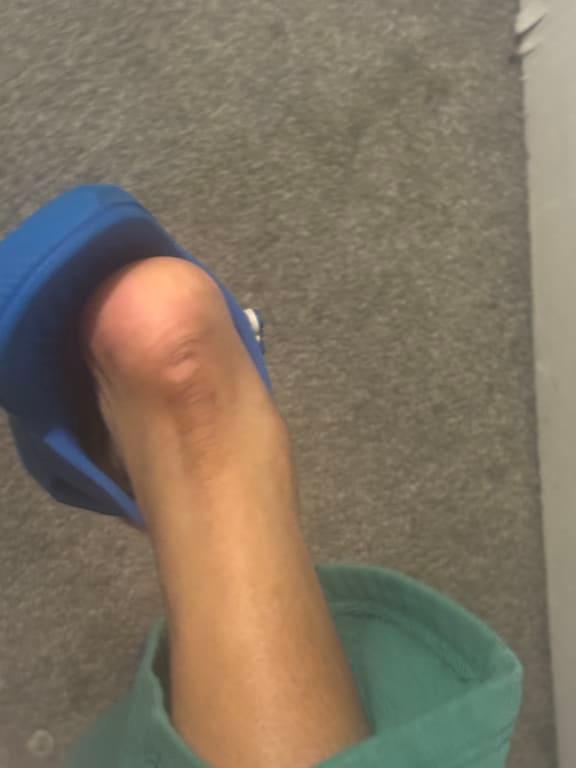 Photo submitted with review of product