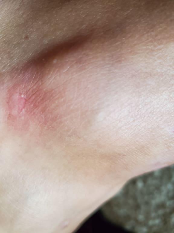 After only 10 minutes of walking