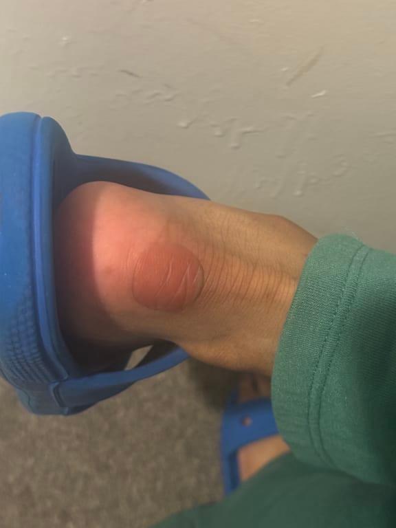 Photo submitted with review of product