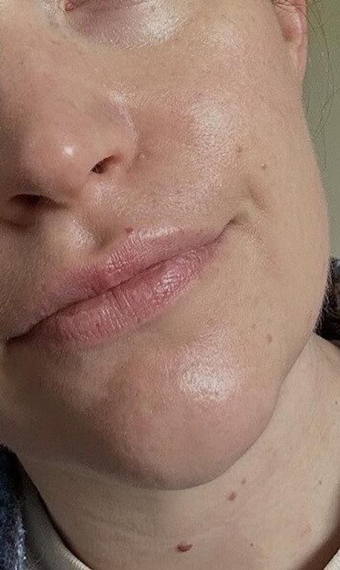 Customer photo for "Very effective"