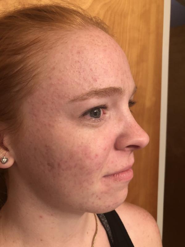 Customer photo for "Not seeing any results, using"