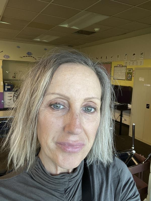 Customer photo for "Phyto-Retinol Sleep Serum,"