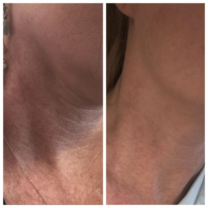 Customer photo for "Loving It!"