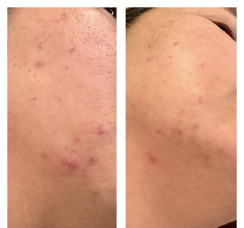 Customer photo for "I have been using the"