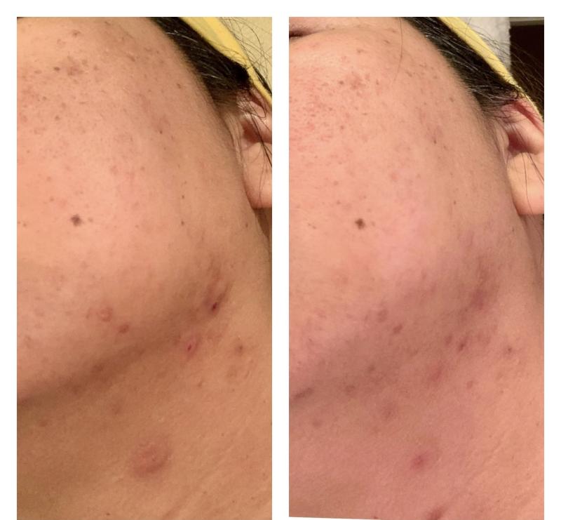 Customer photo for "I have been using the"