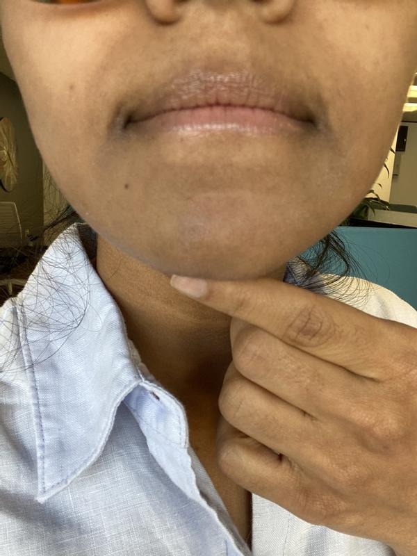 Customer photo for "I started to get a"