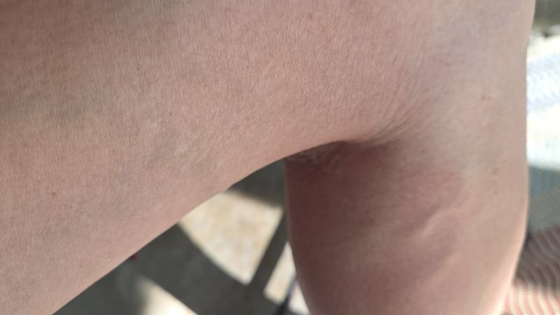 Just a few of their bites