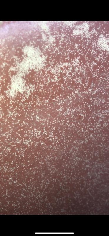 Mites inside of our food barrel, all of the white specks are the bugs