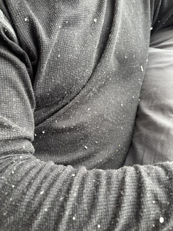 Fleece balls all over