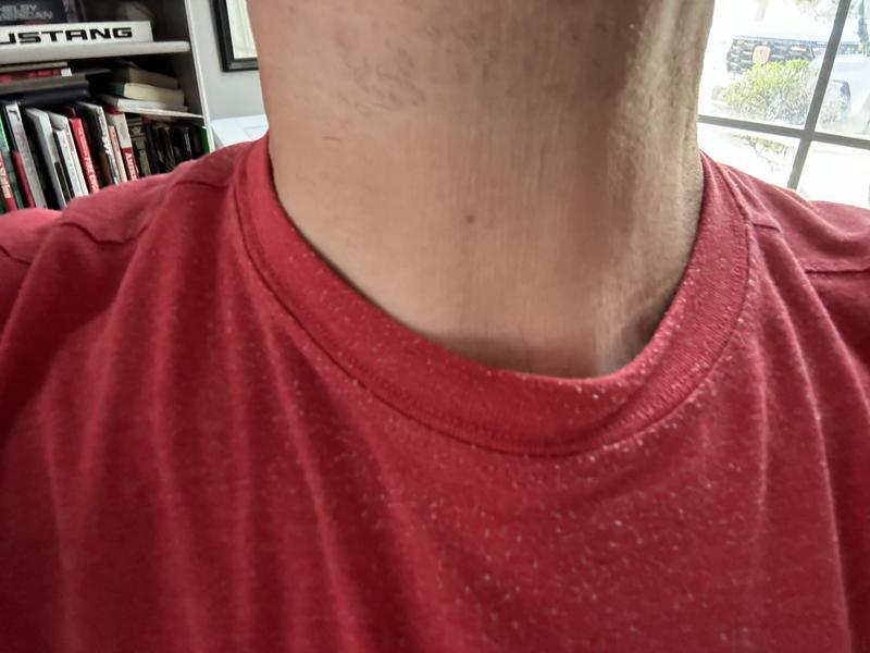 Pills after three washes in just this area, I have no beard or stubble.